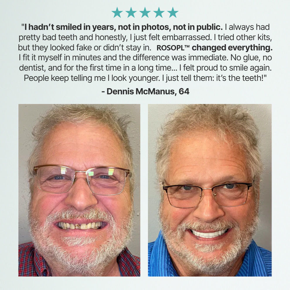 ROSOPL DENTURES-Boil-and-Bite Functional Denture, Self-fit at Home, Fully Adjustable for Narrow or Wide Arches, Long or Short-term Solution, Eat, Drink and Smile Confidently