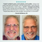 ROSOPL DENTURES-Boil-and-Bite Functional Denture, Self-fit at Home, Fully Adjustable for Narrow or Wide Arches, Long or Short-term Solution, Eat, Drink and Smile Confidently