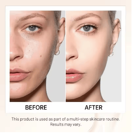 💖 Achieve Flawless Skin ✨Foundation 4 in 1 - Light Spectrum