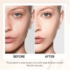 💖 Achieve Flawless Skin ✨Foundation 4 in 1 - Light Spectrum