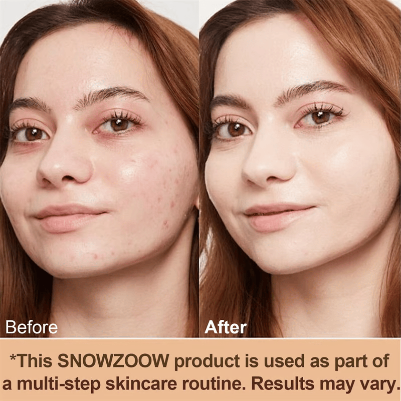 💖 Achieve Flawless Skin ✨Foundation 4 in 1 - Light Spectrum