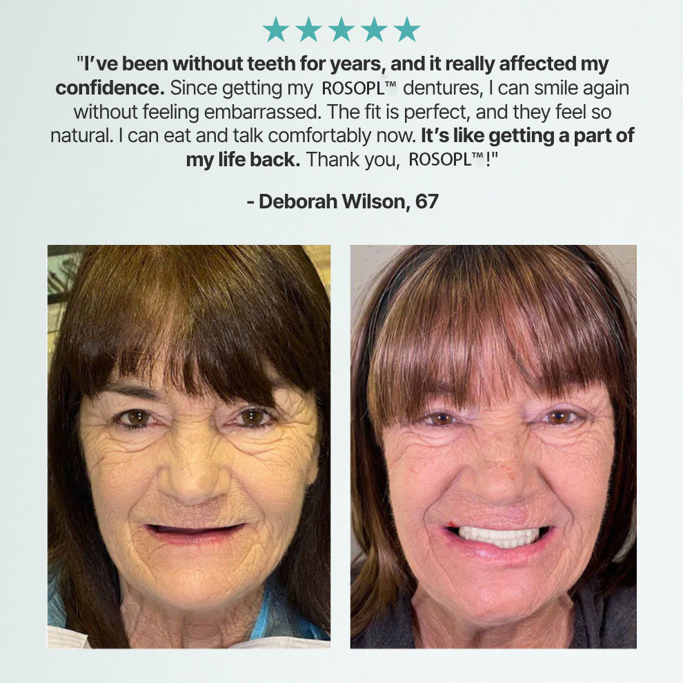 ROSOPL DENTURES-Boil-and-Bite Functional Denture, Self-fit at Home, Fully Adjustable for Narrow or Wide Arches, Long or Short-term Solution, Eat, Drink and Smile Confidently