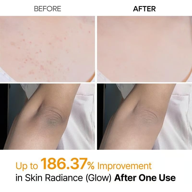 🌸 New! Peeling Shot Keratin Care Kojic Acid Turmeric Spray