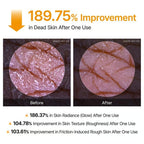 🌸 New! Peeling Shot Keratin Care Kojic Acid Turmeric Spray