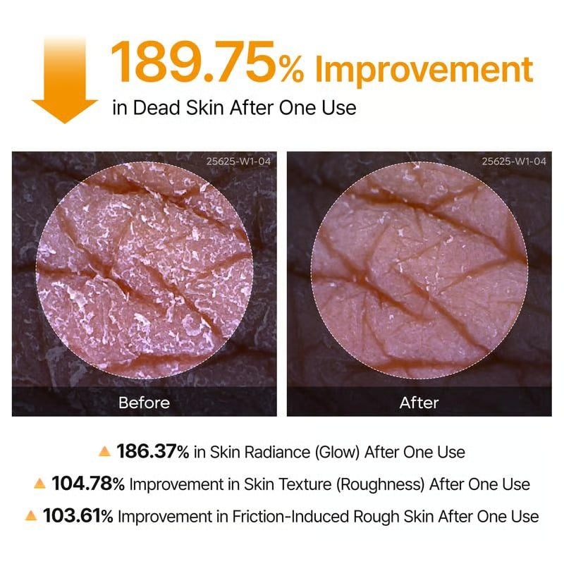 🌸 New! Peeling Shot Keratin Care Kojic Acid Turmeric Spray